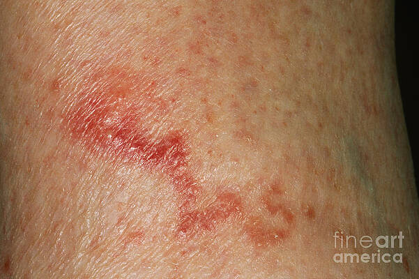 Wall Art - Photograph - Hookworm Larva Trail by Gregory G. Dimijian, M.D.