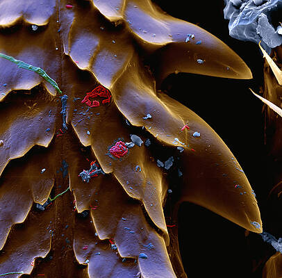 Wall Art - Photograph - Lyme Disease by Eye of Science