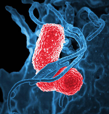 Wall Art - Photograph - Mdr Pathogen, Klebsiella Pneumoniae, Sem by Science Source