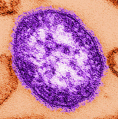 Wall Art - Photograph - Measles Virus, Tem by Science Source