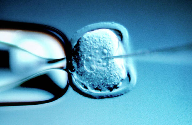 Wall Art - Photograph - Microinjection Of Foreign Dna by Marc Steinmetz