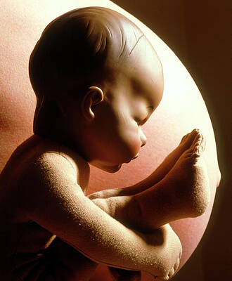 Wall Art - Photograph - Model Of A Breech Birth Foetus by Science Photo Library