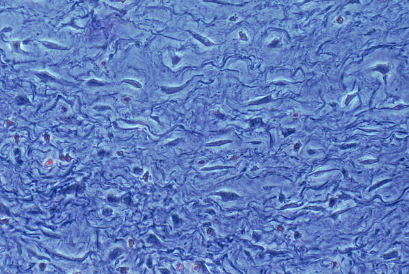 Wall Art - Photograph - Mucous Connective Tissue by Biology Pics