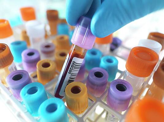 Wall Art - Photograph - Person Selecting A Blood Sample by Science Photo Library