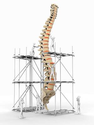 Wall Art - Photograph - Spine With Workers by Science Photo Library