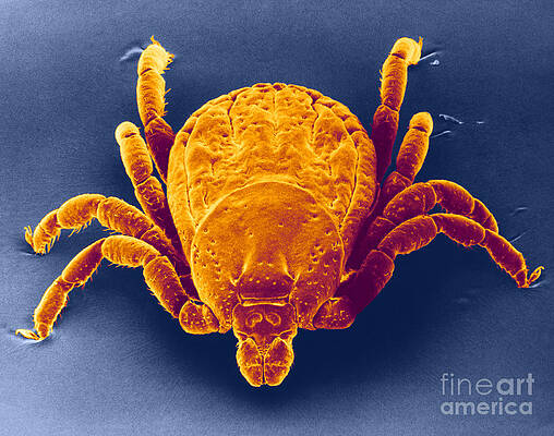 Wall Art - Photograph - Spotted Fever Tick, Sem by David M. Phillips