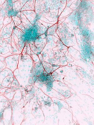 Wall Art - Photograph - Stem cell-derived neurons, micrograph by Science Photo Library
