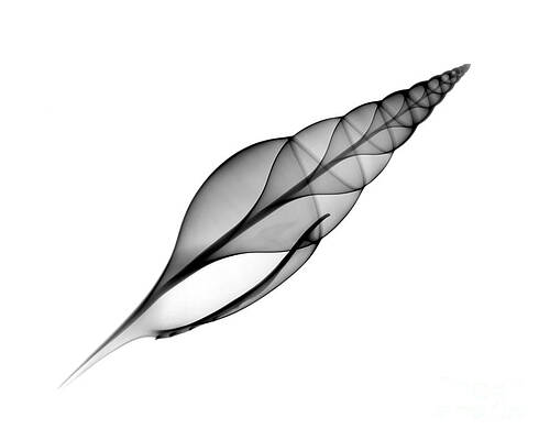 Wall Art - Photograph - X-ray Of Martins Tibia by Bert Myers