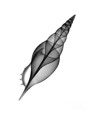 Wall Art - Photograph - X-ray Of Tibia Shell by Bert Myers