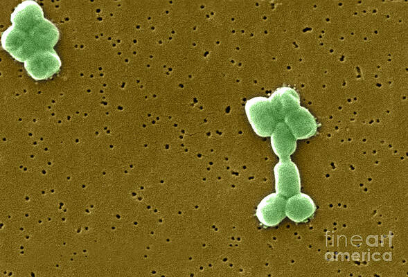 Wall Art - Photograph - Acinetobacter Baumannii Bacteria, Sem #1 by Science Source