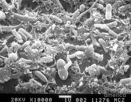 Wall Art - Photograph - Bacteria In Raw Sewage Sem #1 by Science Source