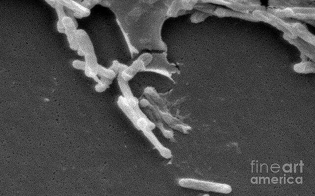Wall Art - Photograph - Clostridium Difficile Bacteria, Sem #1 by Science Source