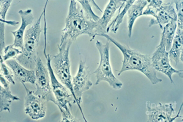 Wall Art - Photograph - Connective Tissue Cells #1 by Science Source