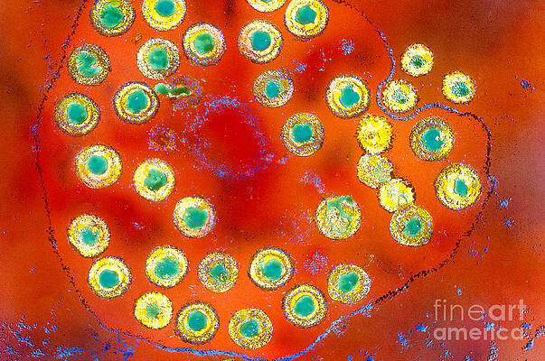 Wall Art - Photograph - Herpes Simplex #1 by Science Source