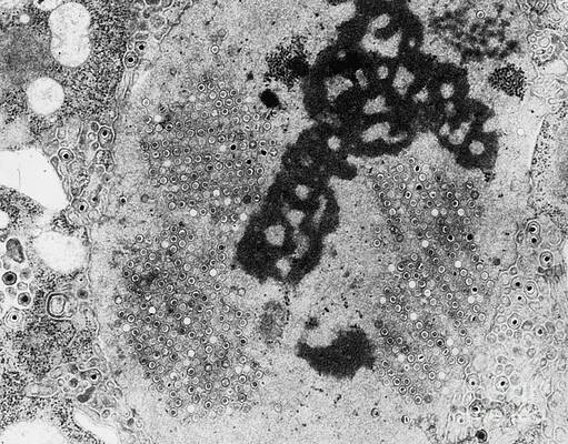 Wall Art - Photograph - Herpes Simplex Virus #1 by Science Source