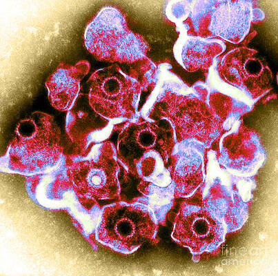 Wall Art - Photograph - Herpes Simplex Virus Tem #1 by ASM/Science Source