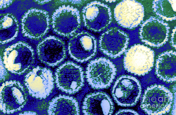 Wall Art - Photograph - Herpes Simplex Virus, Tem #1 by Science Source