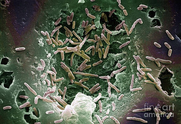Wall Art - Photograph - Mycobacterium Chelonae #1 by Science Source