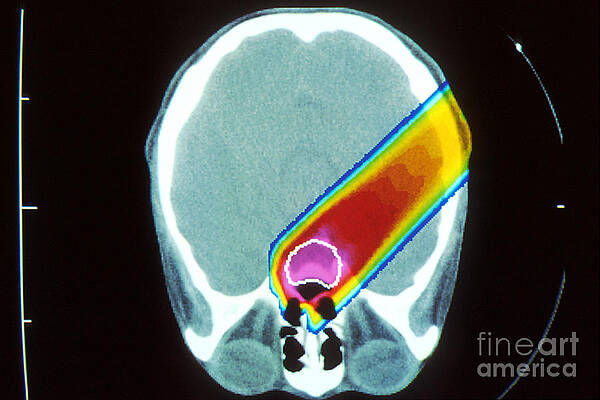 Wall Art - Photograph - Proton Beam From Brain During Ct Scan #1 by Science Source