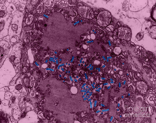 Wall Art - Photograph - Rabies Virus, Tem #1 by Science Source