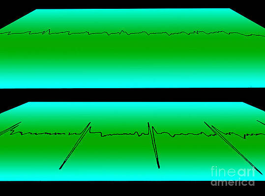 Wall Art - Photograph - Atrial Flutter & Normal Heart Beat #2 by Science Source