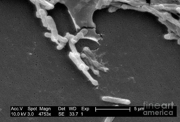 Wall Art - Photograph - Clostridium Difficile Bacteria, Sem #2 by Science Source
