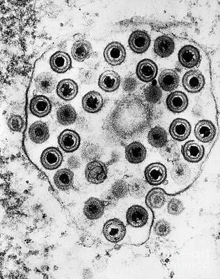 Wall Art - Photograph - Herpes #2 by Science Source