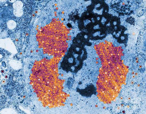 Wall Art - Photograph - Herpes Simplex Virus #2 by Science Source