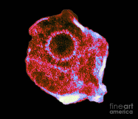 Wall Art - Photograph - Herpes Simplex Virus Tem #2 by ASM/Science Source
