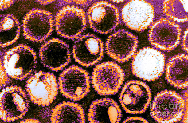Wall Art - Photograph - Herpes Simplex Virus, Tem #2 by Science Source