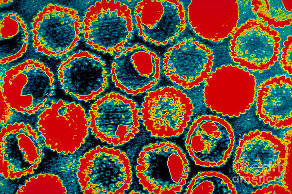 Wall Art - Photograph - Herpes Virus #2 by Science Source