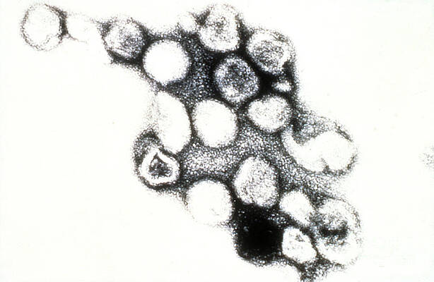 Wall Art - Photograph - Tem Of Rubella German Measles #2 by Science Source