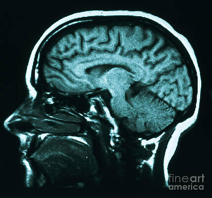 Wall Art - Photograph - Mri Of Normal Brain #49 by Science Source