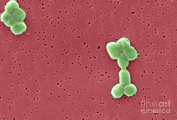 Wall Art - Photograph - Acinetobacter Baumannii Bacteria, Sem #3 by Science Source