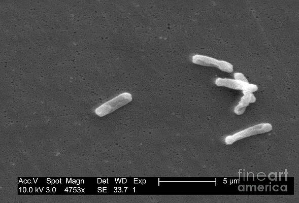 Wall Art - Photograph - Clostridium Difficile Bacteria, Sem #3 by Science Source