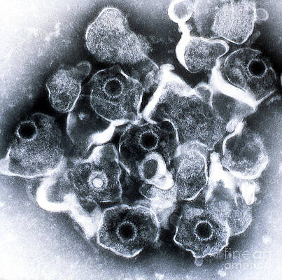 Wall Art - Photograph - Herpes Simplex Virus Tem #3 by ASM/Science Source