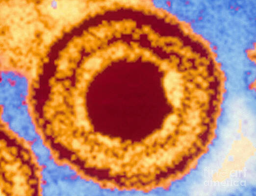Wall Art - Photograph - Herpes Simplex Virus Tem #3 by Science Source