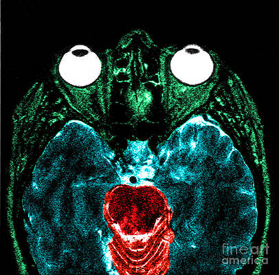 Wall Art - Photograph - Mri Of Normal Brain #36 by Science Source