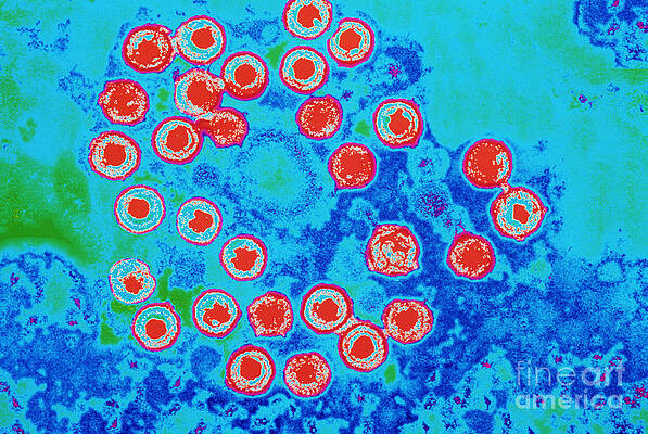 Wall Art - Photograph - Herpes Simplex Virus #4 by Science Source