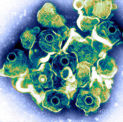 Wall Art - Photograph - Herpes Simplex Virus Tem #4 by ASM/Science Source