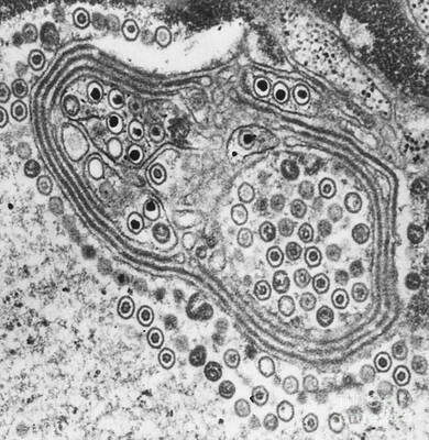 Wall Art - Photograph - Herpes Simplex Virus, Tem #4 by Science Source