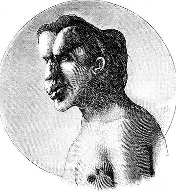 Wall Art - Photograph - Joseph Merrick, The Elephant Man #4 by Science Source