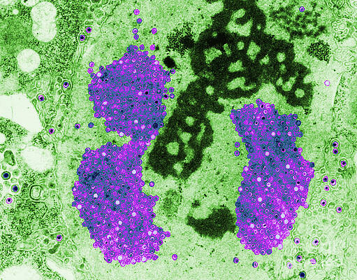 Wall Art - Photograph - Herpes Simplex Virus #5 by Science Source