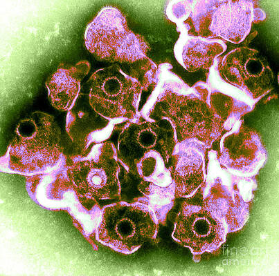 Wall Art - Photograph - Herpes Simplex Virus Tem #5 by ASM/Science Source