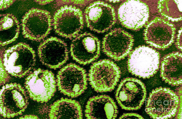 Wall Art - Photograph - Herpes Simplex Virus, Tem #5 by Science Source