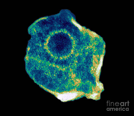 Wall Art - Photograph - Herpes Simplex Virus Tem #6 by ASM/Science Source
