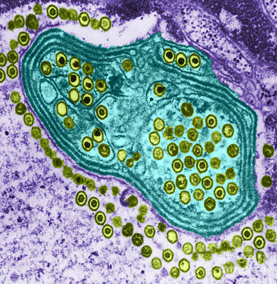 Wall Art - Photograph - Herpes Simplex Virus, Tem #6 by Science Source
