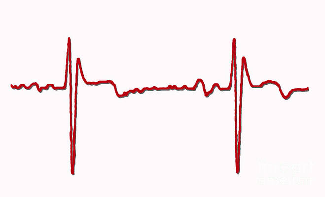 Wall Art - Photograph - Normal Ecg #6 by Science Source