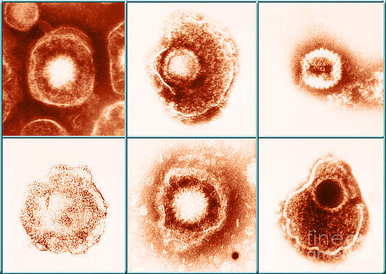 Wall Art - Photograph - Various Forms Of Herpes Simplex Virus #8 by Science Source