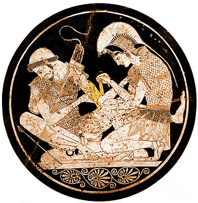 Wall Art - Photograph - Achilles Tending Patroclus Wounds by Science Source